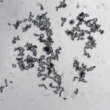 Attēlu rezultāti vaicājumam “Akanthomyces aculeatus”