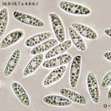 Attēlu rezultāti vaicājumam “Hymenoscyphus calyculus”