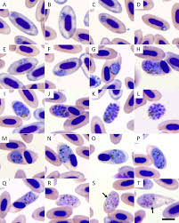 Attēlu rezultāti vaicājumam “Diderma cingulatum plasmodium”