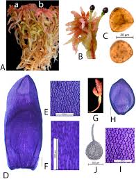 Attēlu rezultāti vaicājumam “Sphagnum sporophyte”