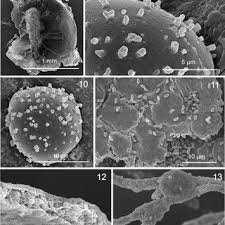 Attēlu rezultāti vaicājumam “Diderma cinereum spores”