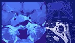 Image result for przyk adnica