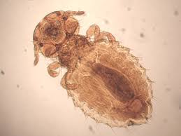 Attēlu rezultāti vaicājumam “Licea pygmaea sessile”