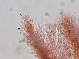 Attēlu rezultāti vaicājumam “Sidera lenis”