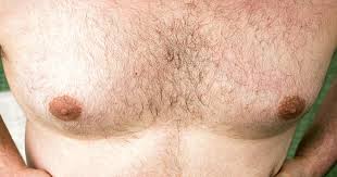 Image result for manboobs