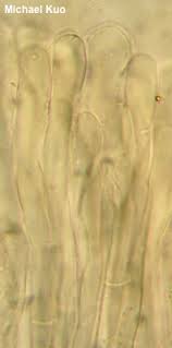 Attēlu rezultāti vaicājumam “Disciotis venosa”