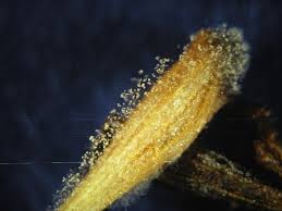 Attēlu rezultāti vaicājumam “Trichia botrytis spores”