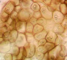 Attēlu rezultāti vaicājumam “Lycogala sphaeroconicum macro”