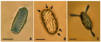 Attēlu rezultāti vaicājumam “Melampsoridium sp.”