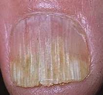http://t0.gstatic.com/images?q=tbn:ANd9GcQD4slUOPWq6baWaAJtK1ItMm03jw3q_a0gmsg7jDkJ1w6gtE4&t=1&usg=__uCoM82XAFAa837Fj1lfR0Ay-WoU=
