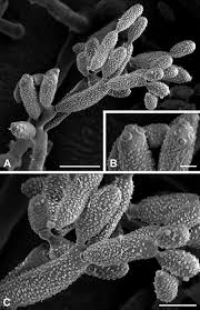 Attēlu rezultāti vaicājumam “Stemonitopsis aequalis var. microspora macro”