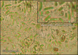 Attēlu rezultāti vaicājumam “Chaenotheca stemonea”