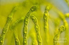Attēlu rezultāti vaicājumam “Trentepohlia sp.”