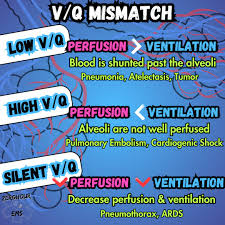 Image result for  v    q