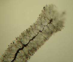 Attēlu rezultāti vaicājumam “Stemonitopsis aequalis var. microspora”