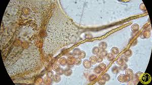 Attēlu rezultāti vaicājumam “Dictydiaethalium plumbeum spores”