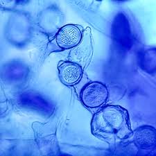 Attēlu rezultāti vaicājumam “Campylopus pyriformis sporophyte”