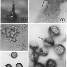 Attēlu rezultāti vaicājumam “Didymium annulisporum”