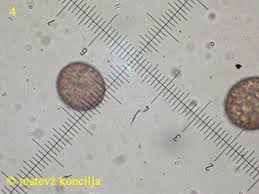 Attēlu rezultāti vaicājumam “Didymium tussilaginis macro”