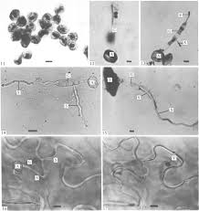 Attēlu rezultāti vaicājumam “Ochropsora ariae spores”