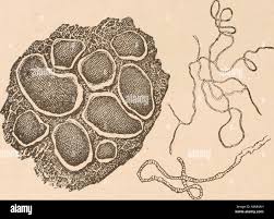 Attēlu rezultāti vaicājumam “Perichaena depressa spores”