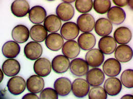 Attēlu rezultāti vaicājumam “Licea testudinacea spores”
