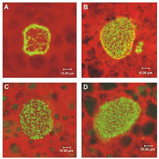 Attēlu rezultāti vaicājumam “Lignydium muscorum plasmodium”