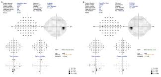 Attēlu rezultāti vaicājumam “Reticularia jurana young”