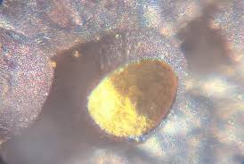 Attēlu rezultāti vaicājumam “Perichaena corticalis macro”