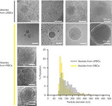 Attēlu rezultāti vaicājumam “undetermined plasmodium”