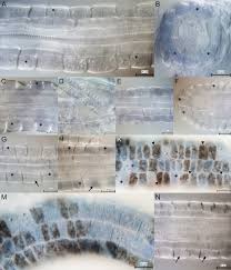 Attēlu rezultāti vaicājumam “Hyaloscypha hyalina”