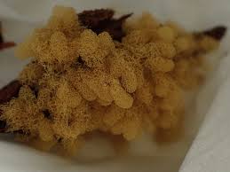 Attēlu rezultāti vaicājumam “Symphytocarpus trechisporus spores”