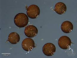 Attēlu rezultāti vaicājumam “Licea castanea spores”