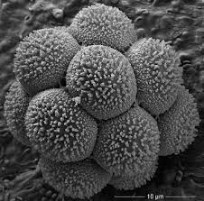 Attēlu rezultāti vaicājumam “Hemitrichia sordivesiculosa spores”