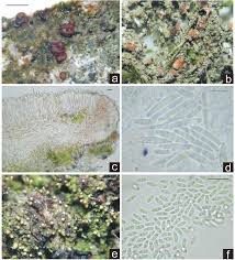 Attēlu rezultāti vaicājumam “Arthonia leucopellaea”