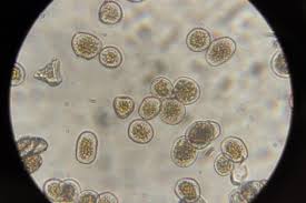 Attēlu rezultāti vaicājumam “Puccinia coronata”