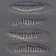 Attēlu rezultāti vaicājumam “Thelotrema lepadinum”