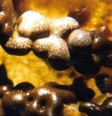 Attēlu rezultāti vaicājumam “Badhamia foliicola spores”