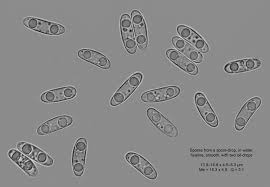 Attēlu rezultāti vaicājumam “Hymenoscyphus calyculus”