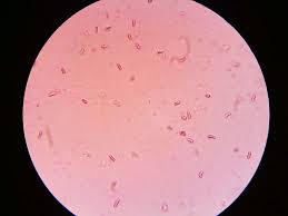 Attēlu rezultāti vaicājumam “Ceriporia”