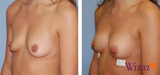 http://t0.gstatic.com/images?q=tbn:ANd9GcQDzBTyKK3rcENj1J1PCFob3_mlMMlo8kJ9Q9Ne4639CVSrstYwZw
