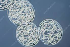 Attēlu rezultāti vaicājumam “Nostoc commune cells”