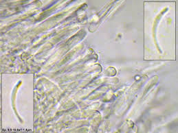 Attēlu rezultāti vaicājumam “Orbilia sp.”