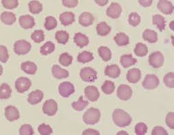 Attēlu rezultāti vaicājumam “Diderma umbilicatum plasmodium”