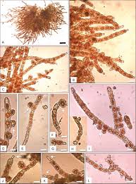 Attēlu rezultāti vaicājumam “Trentepohlia sp.”
