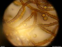 Attēlu rezultāti vaicājumam “Arcyria, Heterotrichia sp.”