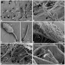 Attēlu rezultāti vaicājumam “Pyrochroidae imago”