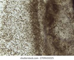 Attēlu rezultāti vaicājumam “Stemonitis flavogenita spores”