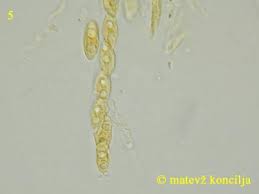 Attēlu rezultāti vaicājumam “Neonectria fuckeliana”