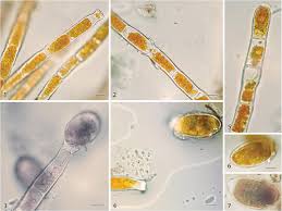 Attēlu rezultāti vaicājumam “Trentepohlia sp.”